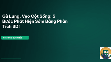 gù lưng